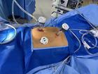 Is Laparoscopic Surgery Painful?